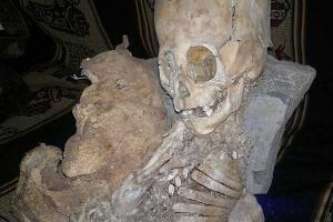 Археологи раскопали останки человека, череп которого имел «яйцеголовую» форму