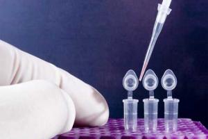 Экспертиза ДНК помогает установить имена погибших бойцов АТО