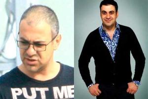 Телеведущего "Comedy Club" пригласили "рекламировать" средства от облысения
