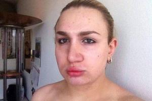 Трансгендер из Германии полностью перекроил лицо, чтобы стать живой куклой