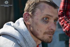 "Держал на цепи и заставлял работать": на Луганщине мужчина истязал подсобных рабочих