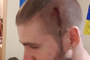 Пошел за гречкой и получил по голове: в Киеве бойцу ВСУ разбили голову