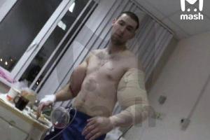 Блогеру Кириллу Терешину врачи не смогли выкачать весь синтол из "рук-базук"