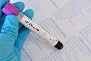 В МОЗ Украины сообщили, в какие месяцы ожидать активизации COVID-19