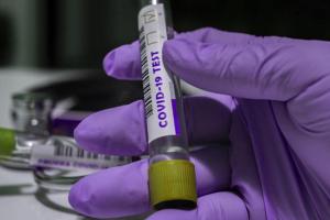 У Луганській області нових випадків COVID-19 не виявлено