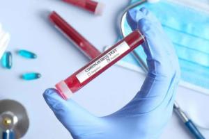 COVID-19 в Украине: за сутки зафиксировано 1112 новых случаев
