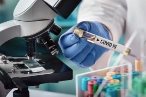 COVID-19 в Україні: за добу виявлено 1658 нових випадків
