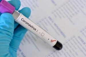 COVID-19 в Украине: за сутки было выявлено 2675 новых случаев заражения