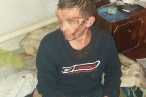 У своєму будинку вже не спокійно: у Лисичанську скоєно розбій (фото)