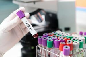 У МОЗ України назвали найбільш небезпечні штами COVID-19
