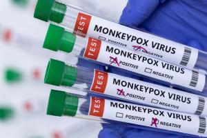 У світі виявлено вже понад 5000 випадків віспи мавп, - ВООЗ