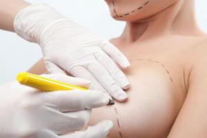 Маммопластика в Киеве: стоимость операции по увеличению груди