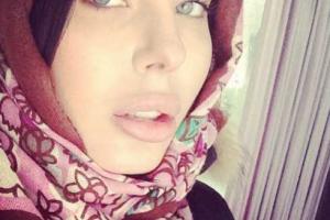 У Алены Лоран изменился нос: поклонники подумали, что она была на Грушевского