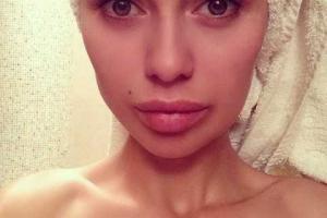 Губам Виктории Бони не хватает места на лице 
