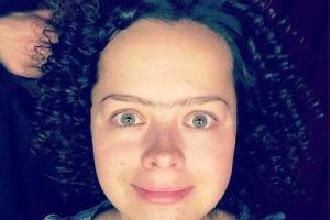 Звезда «Comedy woman» шокировала лицом без макияжа