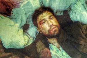 Билан показал кровавые снимки