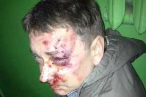 В Сумах в собственном гараже избили журналиста 