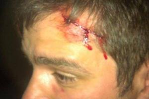 В Киеве избили кандидата в депутаты Киевсовета от "Свободы"