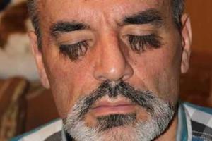 Киевлянин отрастил самые длинные ресницы в Украине