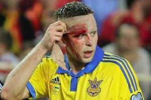Кравцу наложили 2 шва на голове