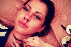 Порнозвезду Елену Беркову жестоко избили