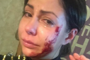 Порно-звезду Елену Беркову жестоко избили