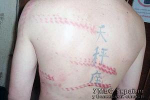 Жителя Волыни избили цепью и обожгли раскаленными плоскогубцами