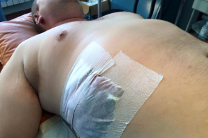 Раненый экс-министр молодежи и спорта опубликовал фото после операции