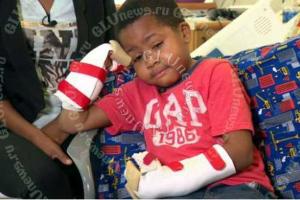 Американские врачи впервые в мире пересадили ребенку донорские руки