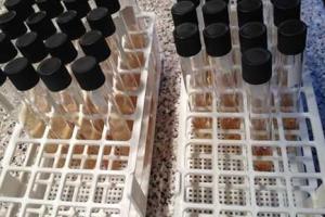 На киевских пляжах можно заразиться неизлечимой болезнью