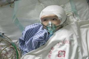 Китайскому ребенку впервые в истории пересадили череп