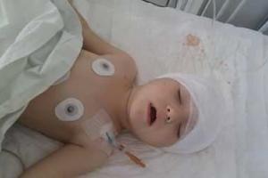 В Харькове собака прокусила череп годовалой девочке