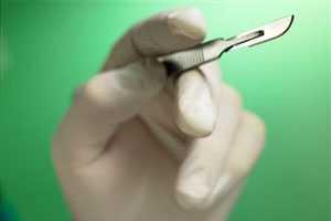 Индийскому мальчику с тремя пенисами отрезали все лишнее