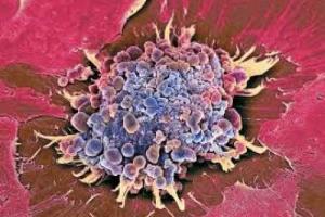 Ученые научились превращать раковые клетки в здоровые