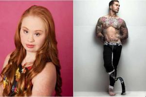 10 самых нестандартных моделей, работающих в индустрии моды