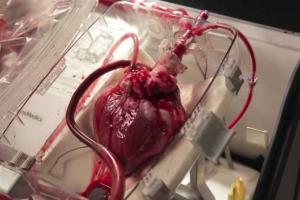 Изобретен аппарат, заставляющий сердце биться без тела