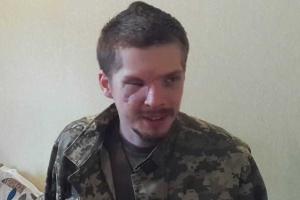 Боец, череп которого врачи собирали по частям, не может получить компенсацию и статус участника боевых действий