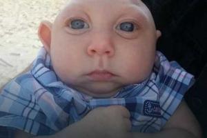 Мальчик без части черепа и головного мозга отпраздновал первый день рождения