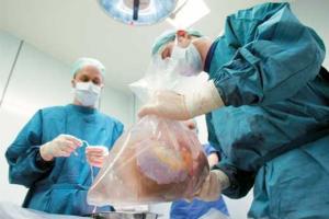 Китаец готов был продать почку ради iPhone 6s