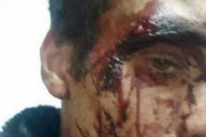 В России жестоко избили беженцев из Донбасса