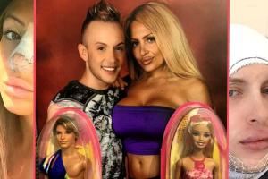 Россиянка и француз решили стать пластиковыми куклами