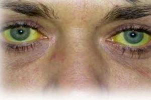 Российские наемники в Сирии массово заразились вирусным гепатитом