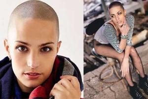 Девушка со страшным диагнозом поражает своей красотой