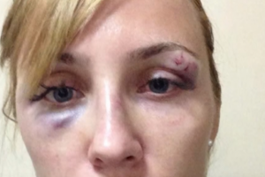 В Шарм-эль-Шейхе жестоко избили российскую туристку