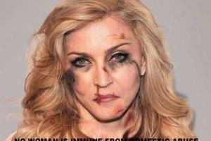 Мадонне сломали нос и разорвали губу