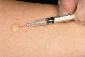 В Смоленске 6-летняя девочка умерла после пробы Манту