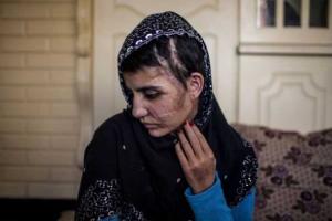 Пакистанка выжила после 15-ти ударов топором