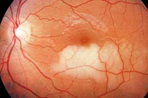 Японские ученые научились возвращать зрение слепым 