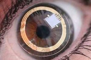 Шанс на спасение: разработан бионический глаз, восстанавливающий зрение