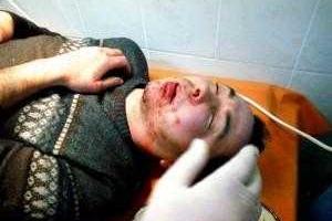 В Каховке жестоко избили нардепа от БПП "Солидарность"